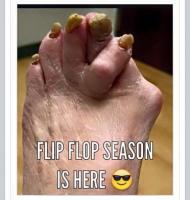 flip flop 11430281_10205553554695919_7479095621493912944_n.jpg